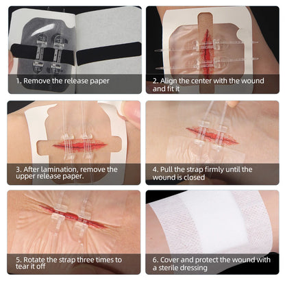 Zipper Band-Aid Wound Tie Emergency Wound Closure Device Repair Wounds Without Stitches Quick Painless Band Aid Health Care