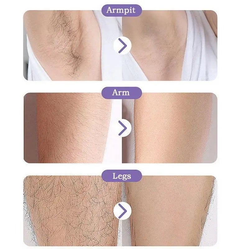 Crystal Epil Hair Removal - Jaazi Intl