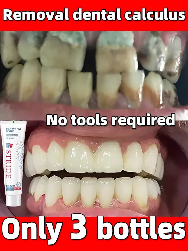 Dental Calculus Remover Whitening Teeth Toothpaste Brightening Preventing Periodontitis Removal Bad Breath Dental Cleansing Care - Jaazi Intl