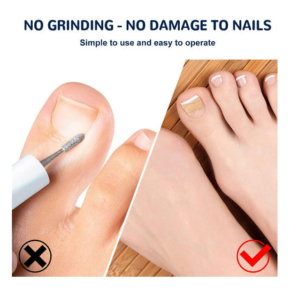 EELHOE toe nail correction patch - Jaazi Intl