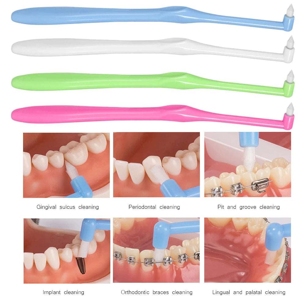 1/2pcs Interdental Brush For Braces Teeth Cleaning Orthodontic Brushes For Braces Soft Hair Tooth-floss Oral Care Cleaning Tools - Jaazi Intl