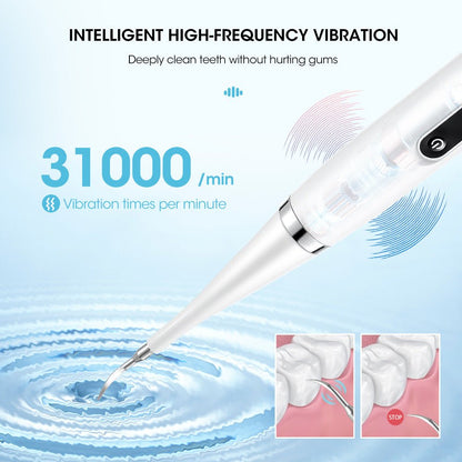 5th Gear Electric Dental Scaler Calculus Remover Dental Scaler Adult Electric Toothbrush - Jaazi Intl