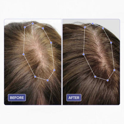 Huile de croissance des cheveux du cuir chevelu