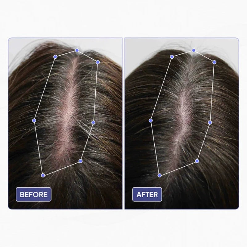 Huile de croissance des cheveux du cuir chevelu